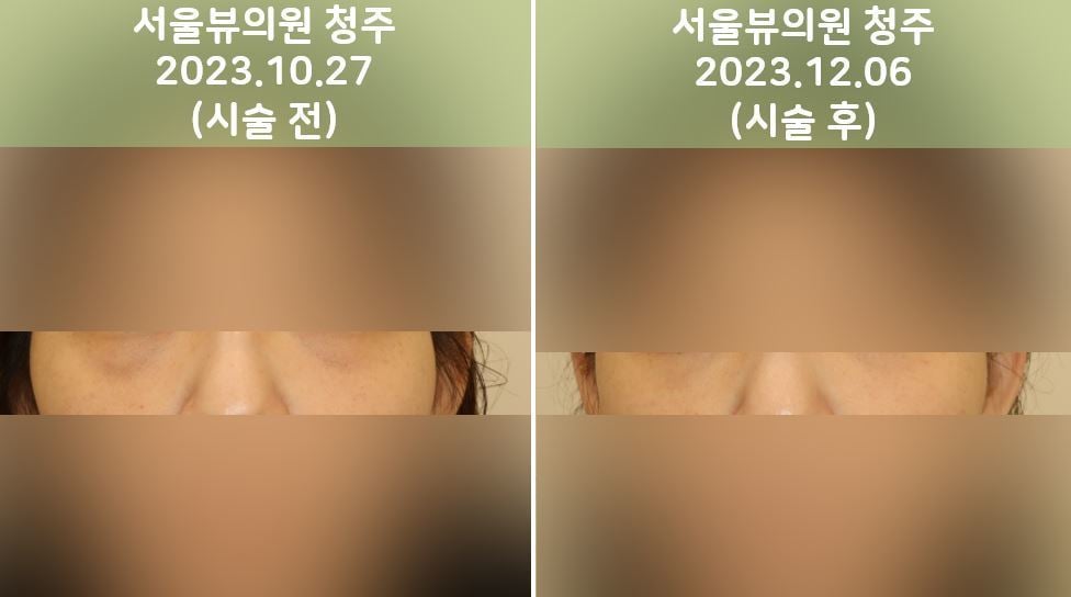 joovelook23