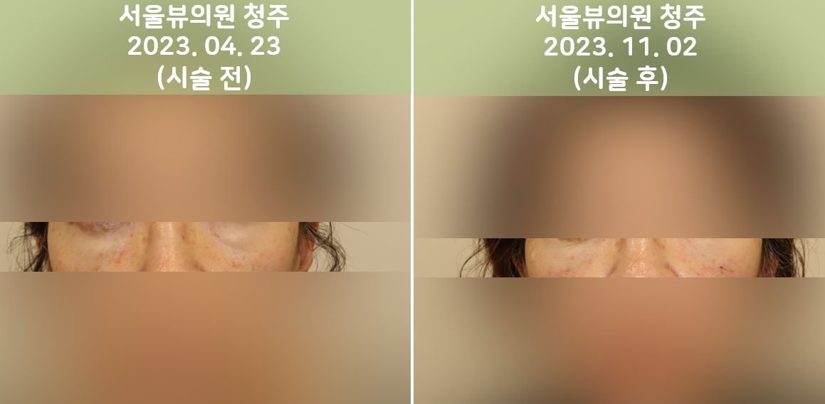 joovelook24