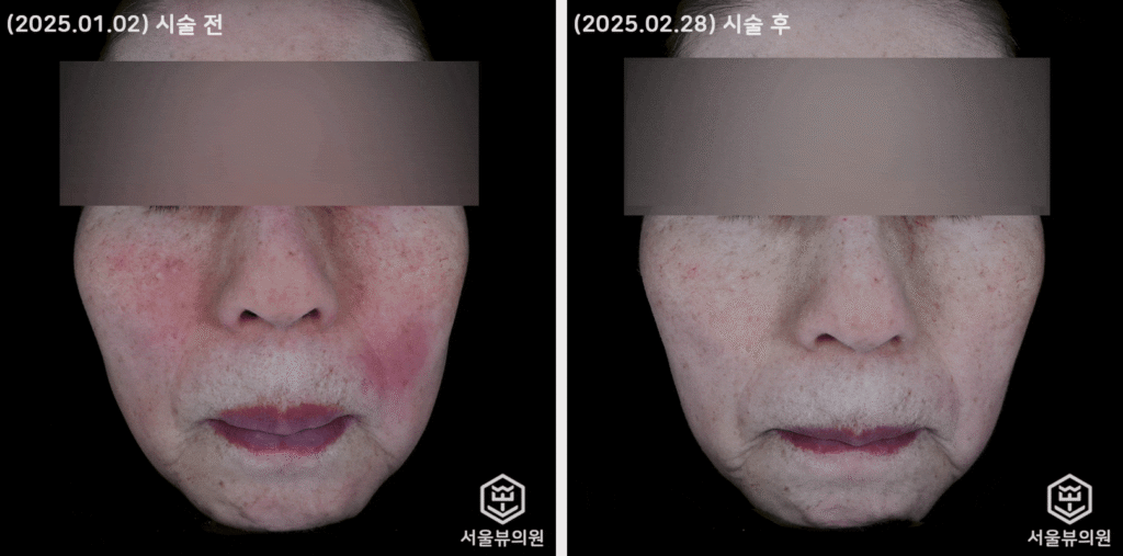 skin1