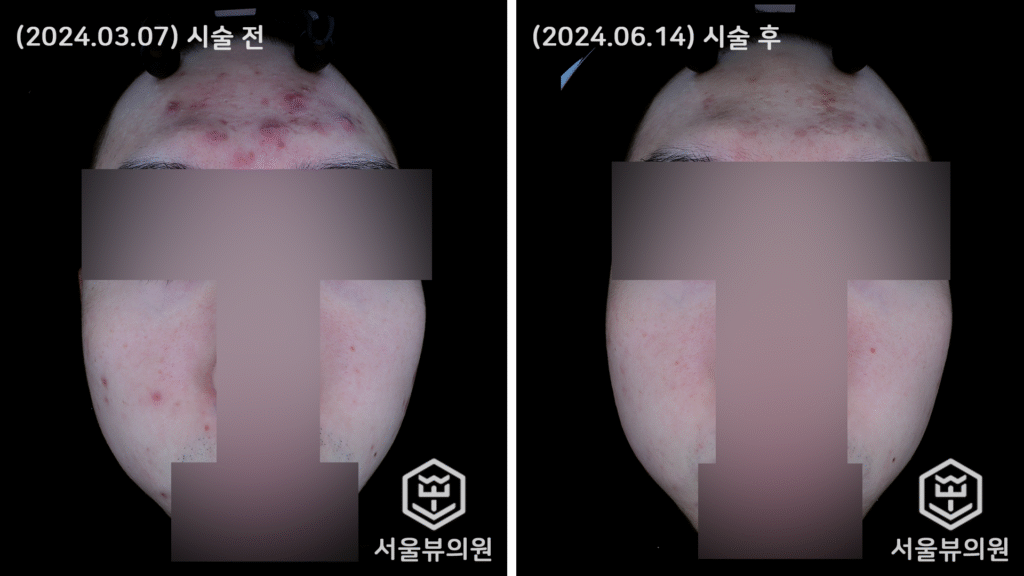 skin12
