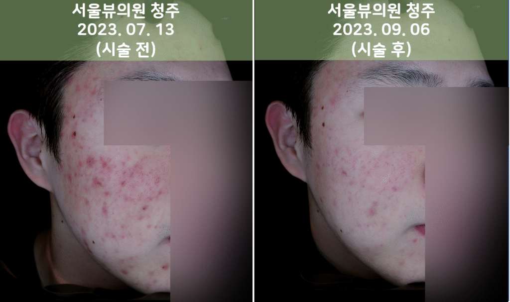 skin13
