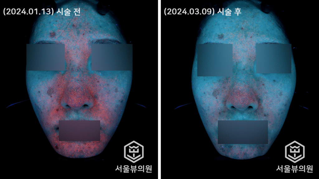 skin15