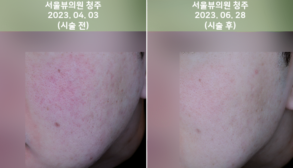 skin16