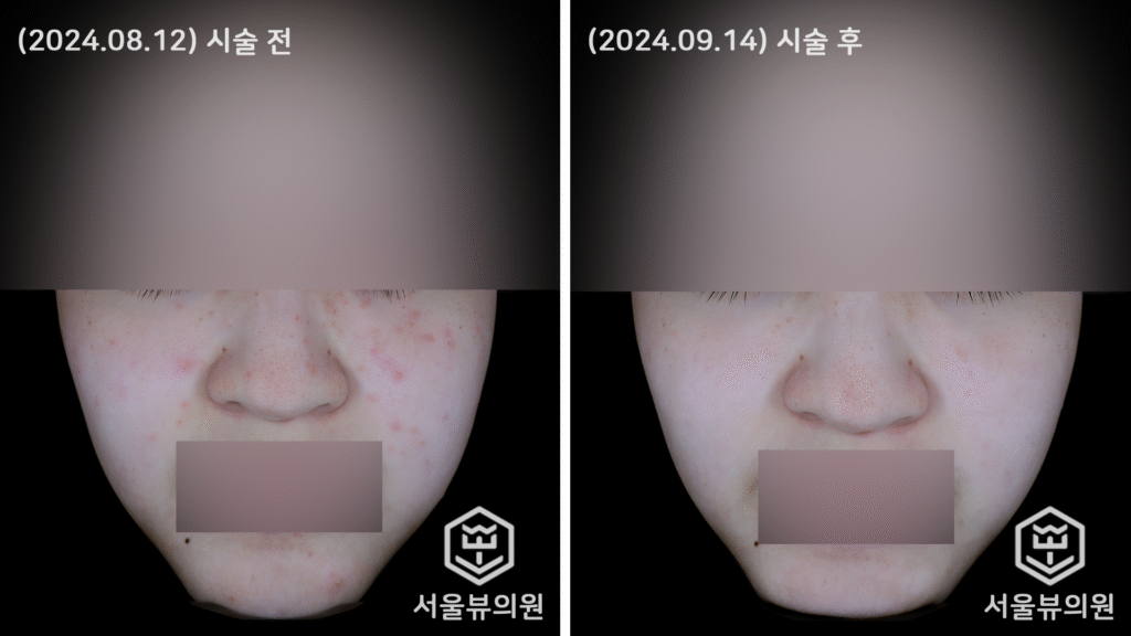 skin19