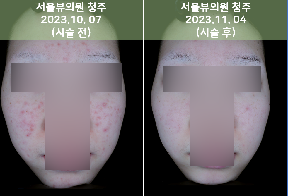 skin21