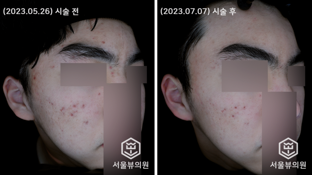 skin22
