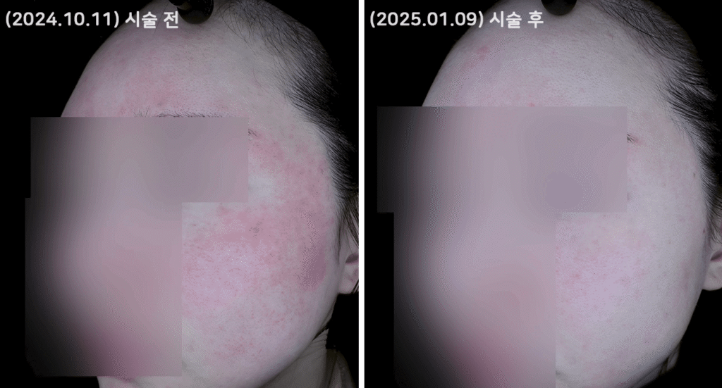 skin3