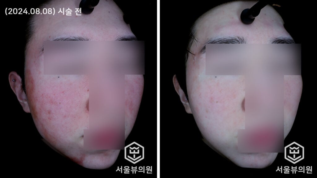 skin5