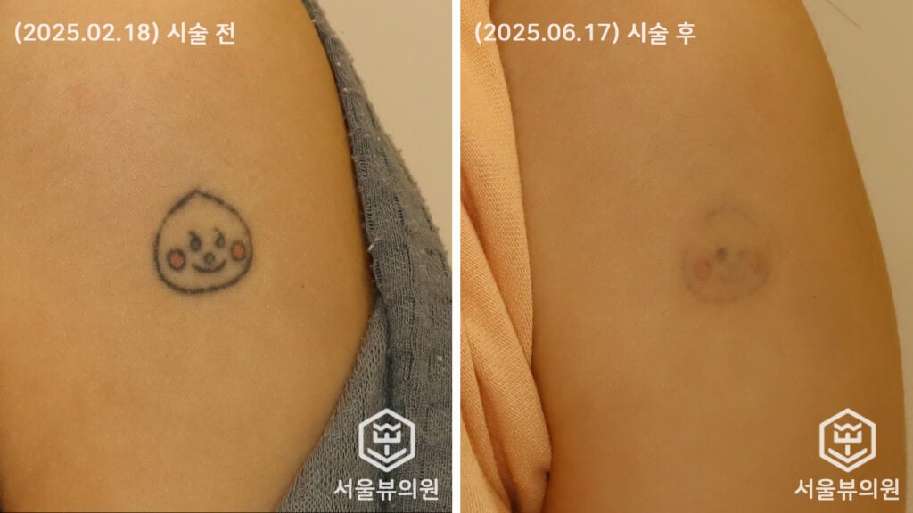 tatoo3
