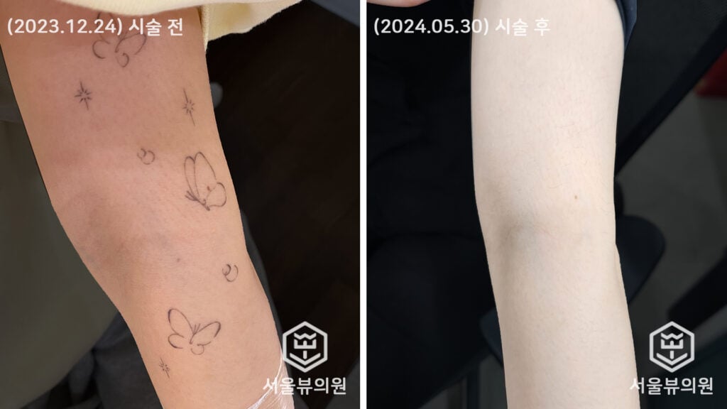 tatoo4