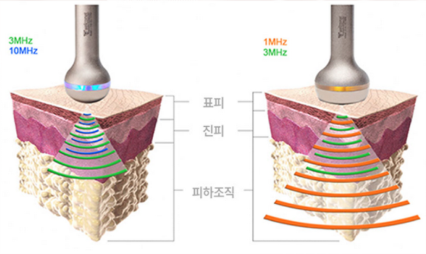 소개 - 장비소개 18 LDM2