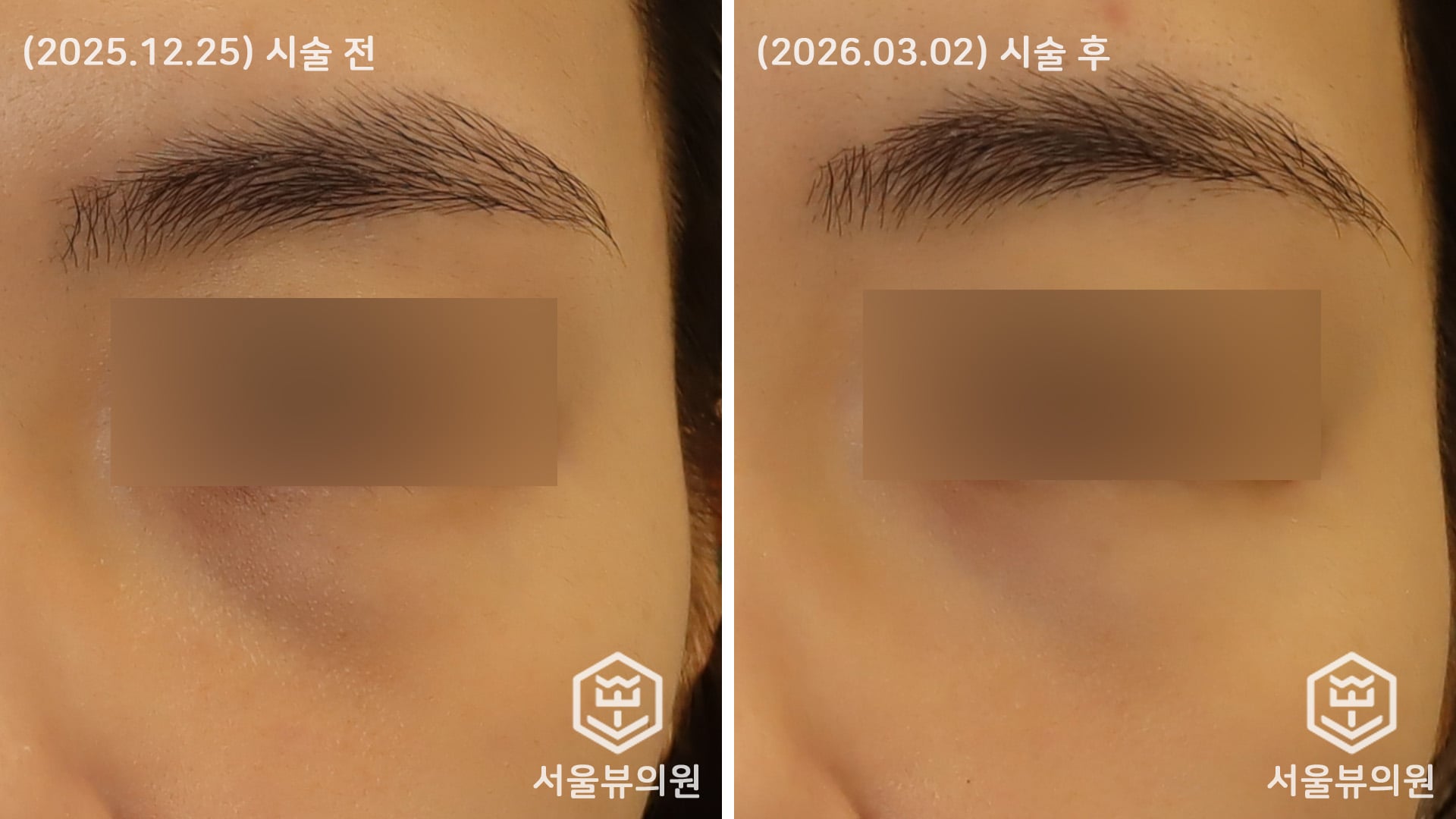 KakaoTalk 20260303 161354260 02