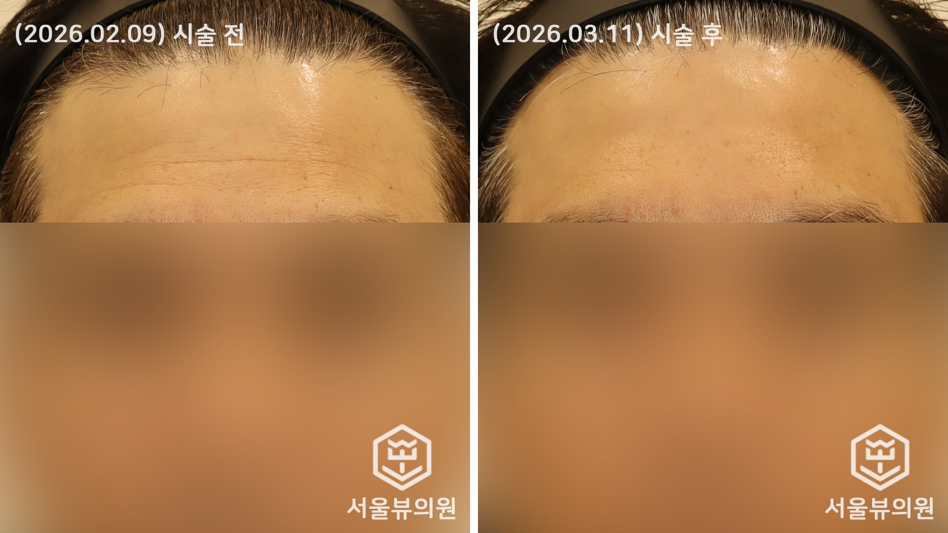 KakaoTalk 20260311 131344274