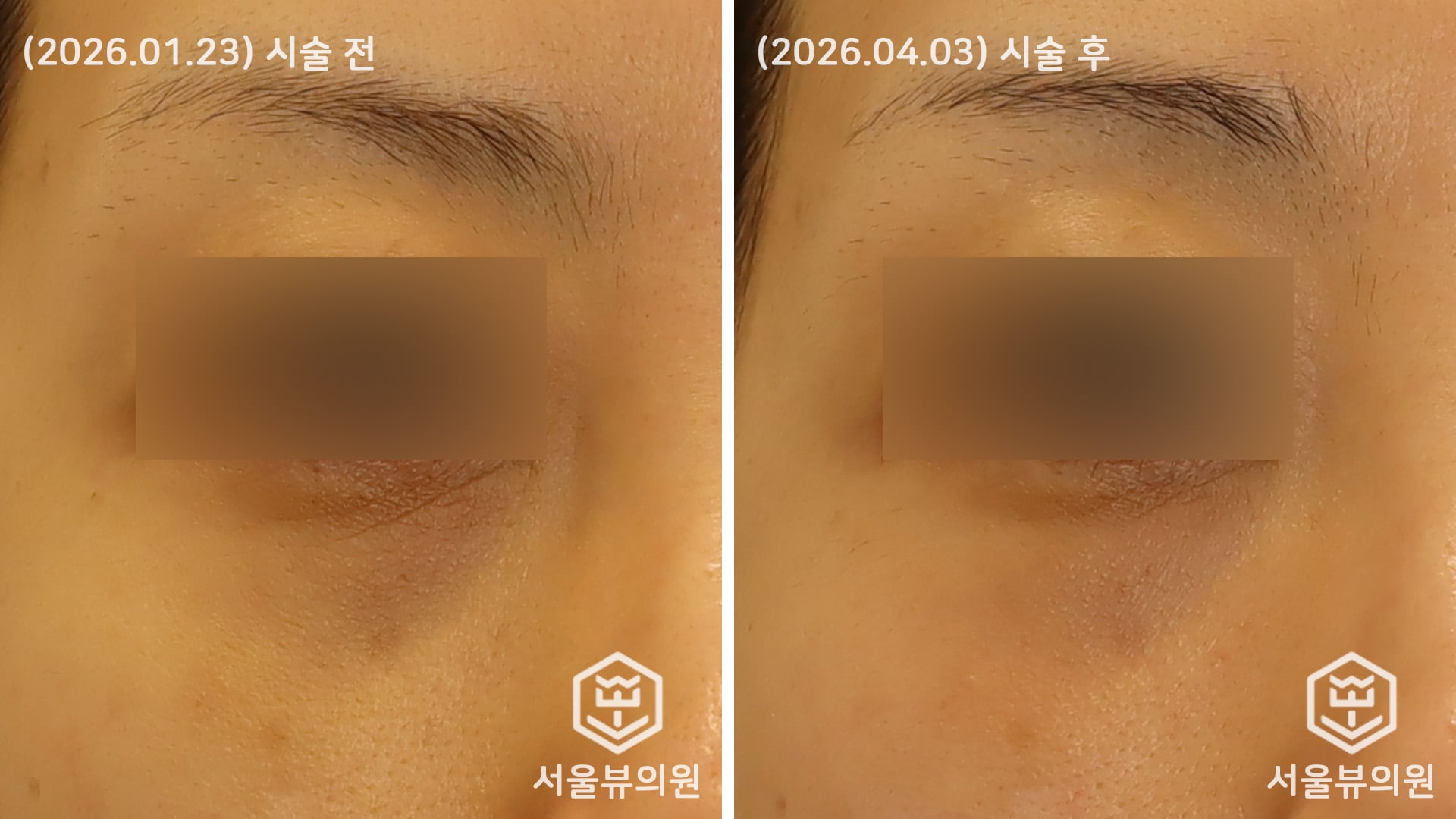 KakaoTalk_20260403_170626723