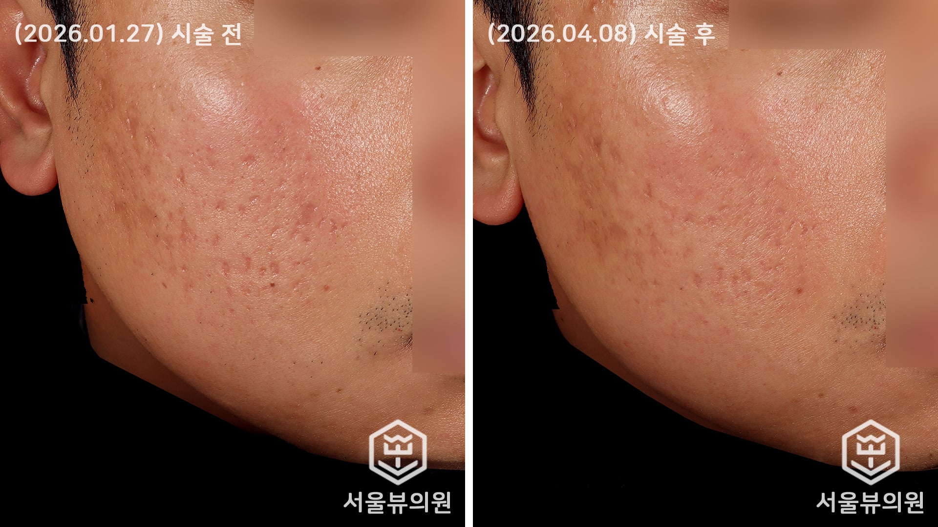 KakaoTalk 20260408 144324885