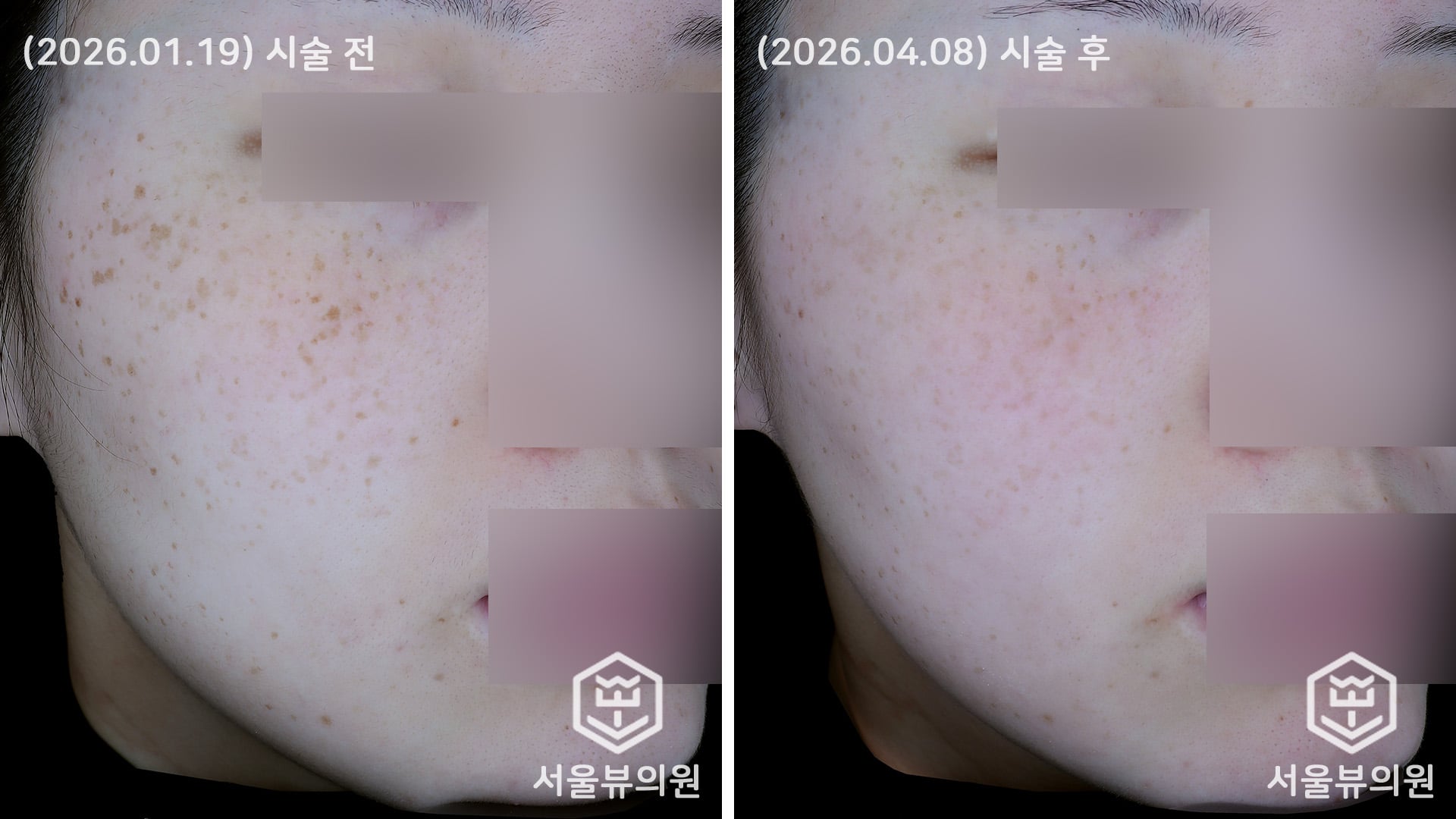 KakaoTalk 20260410 121454148
