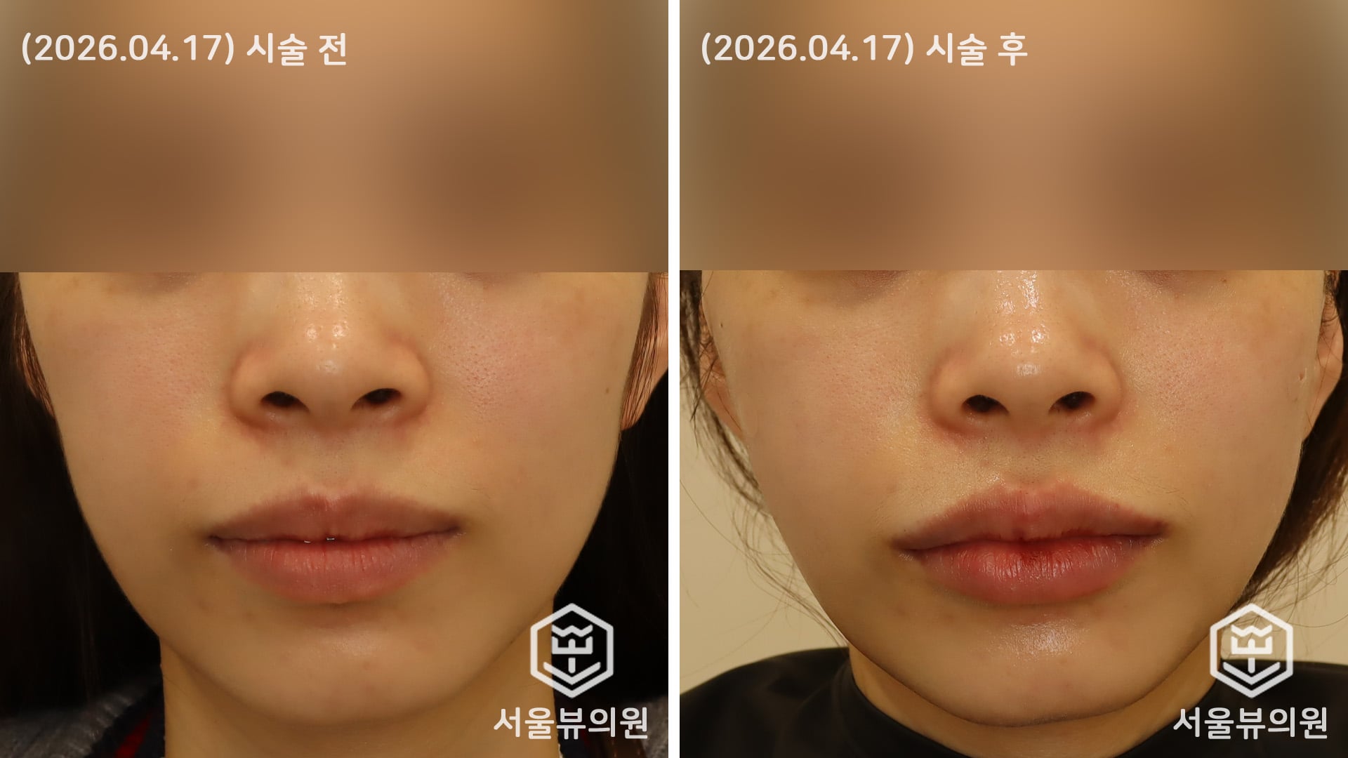 KakaoTalk 20260417 144506736