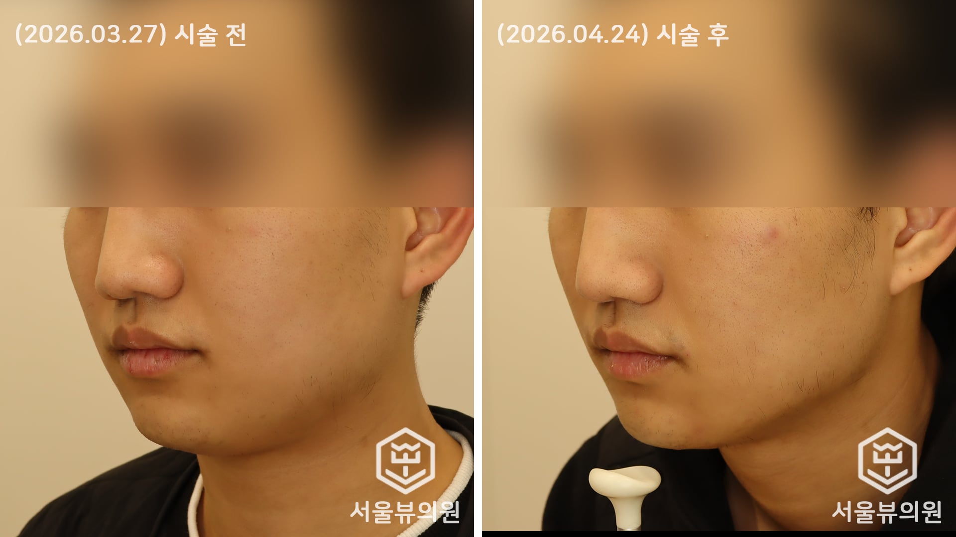 KakaoTalk 20260427 192627993 01
