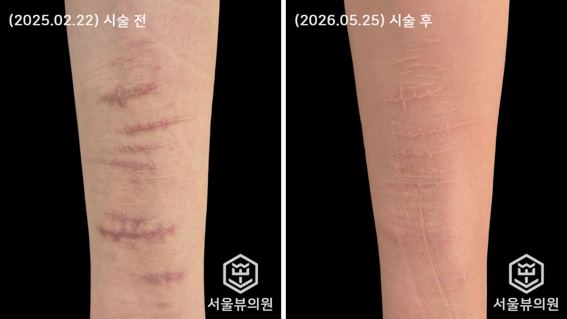 KakaoTalk Photo 2026 05 26 09 53 51
