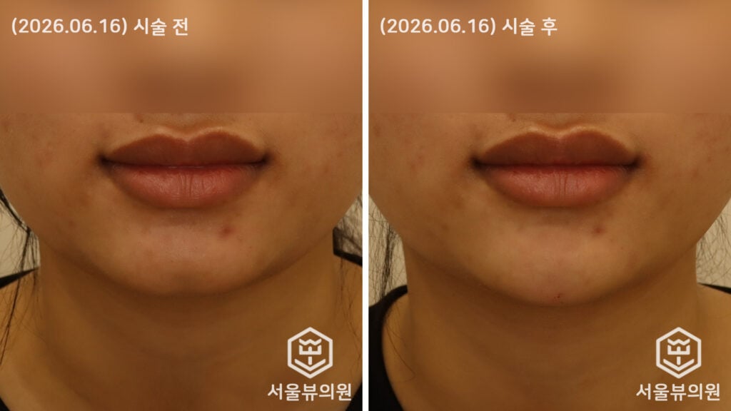 KakaoTalk Photo 2026 06 18 11 17 38