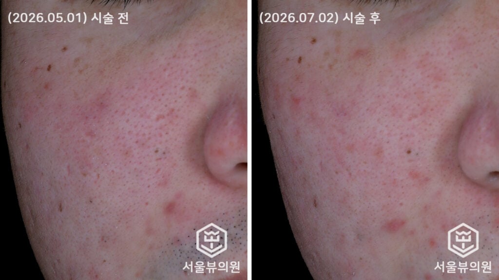 KakaoTalk Photo 2026 07 03 14 45 46
