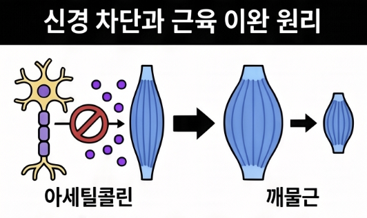 사각턱 보톡스 후 씹을 때 불편한 이유는 무엇인가요?