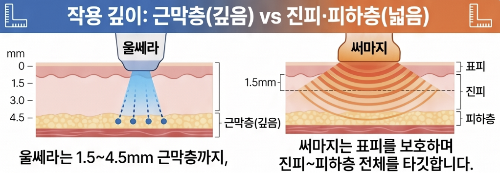 울쎄라와 써마지는 작용 원리가 어떻게 다른가요?