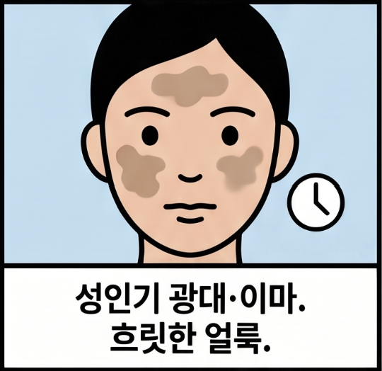 기미 주근깨 차이, 모양과 위치로 알 수 있나요? 2 기미 주근깨 차이, 한눈에 비교하면 어떤가요?