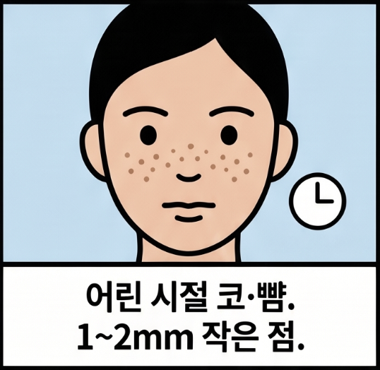 기미 주근깨 차이, 모양과 위치로 알 수 있나요? 3 기미와 주근깨는 어떻게 구분하나요?